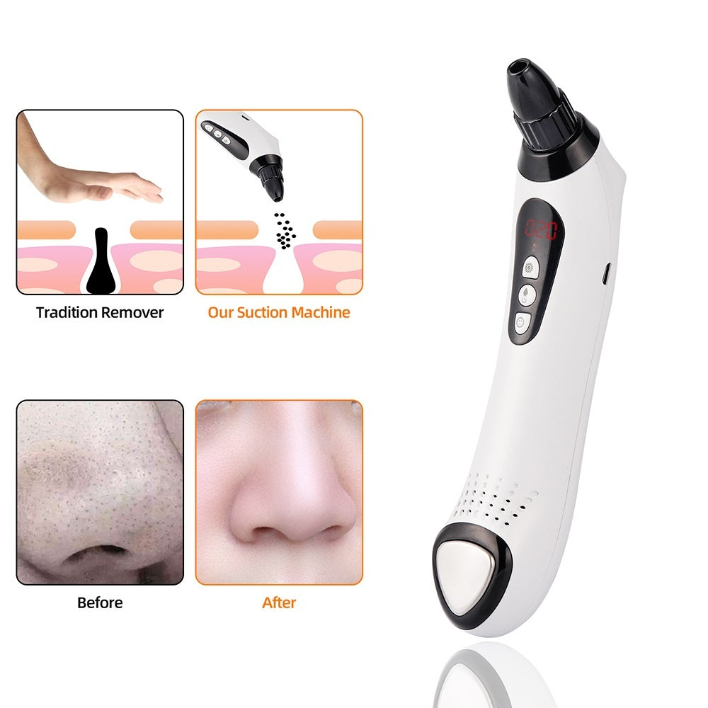 Blackhead Remover