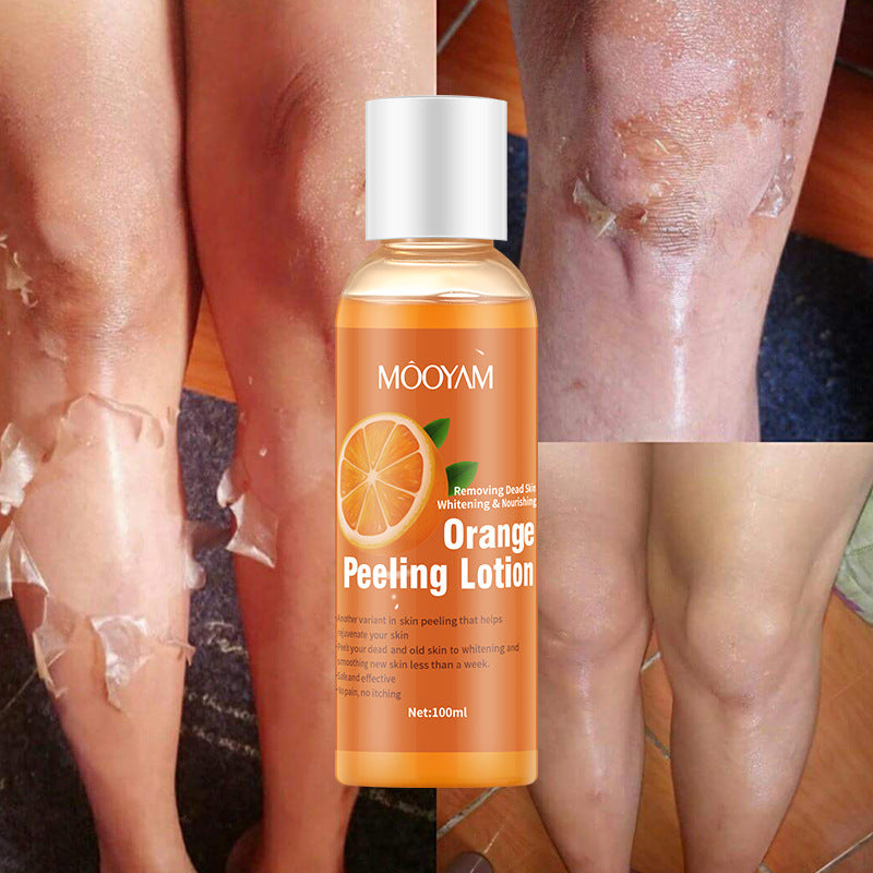 Orange Peel Lotion